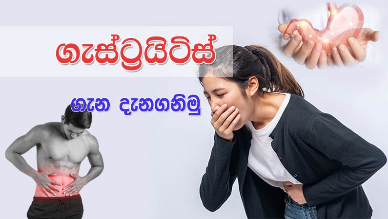 ගැස්ට්‍රයිටිස් ගැන දැන ගනිමු.